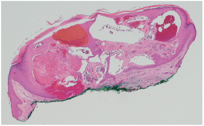 Figure 14