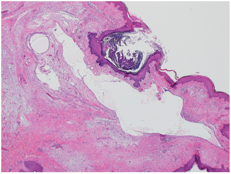 Figure 16