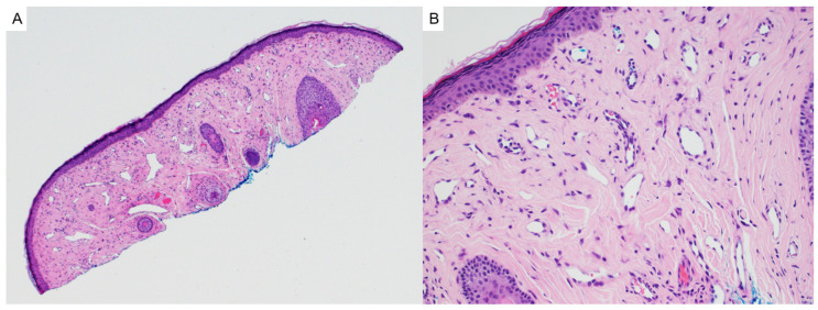 Figure 17