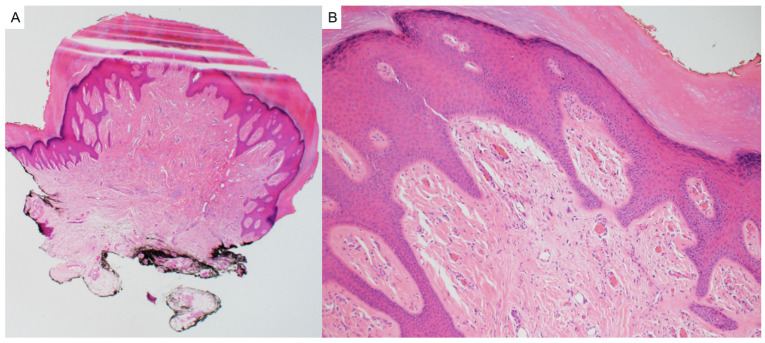 Figure 18