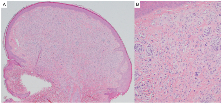 Figure 19