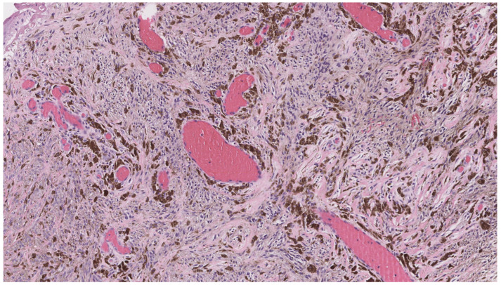 Figure 20