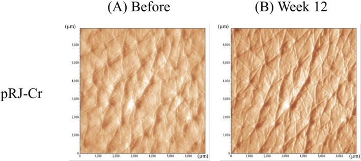 FIGURE 3