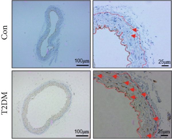 Figure 38