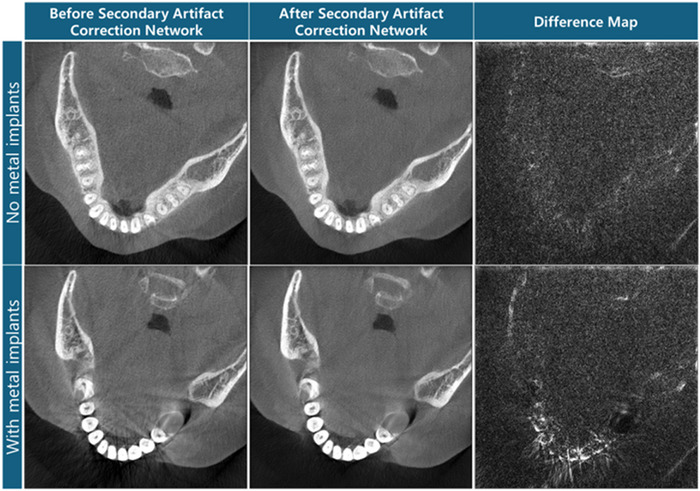Figure 14