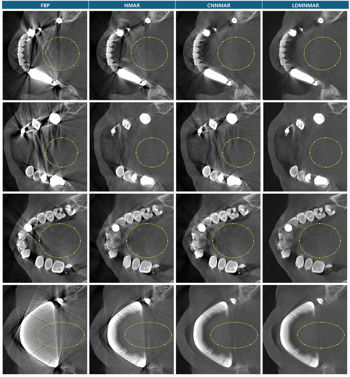 Figure 15