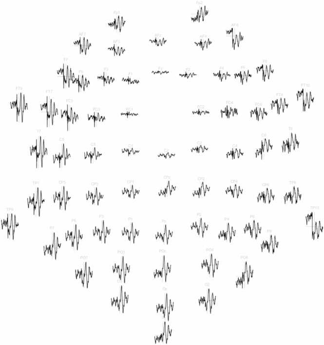 Figure 12