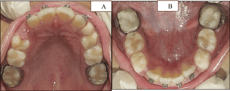 Figure 9