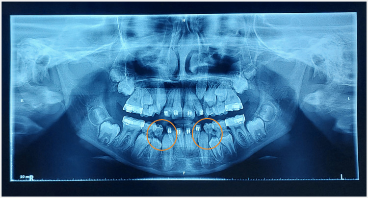 Figure 10