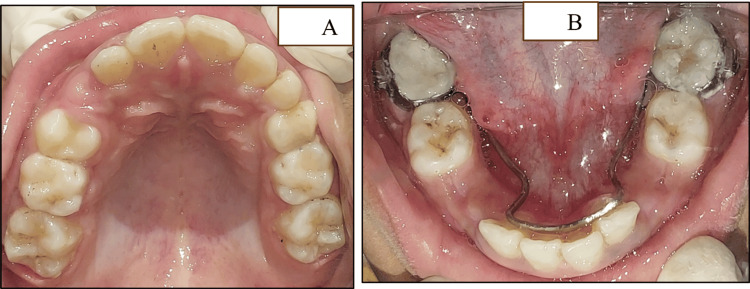 Figure 11