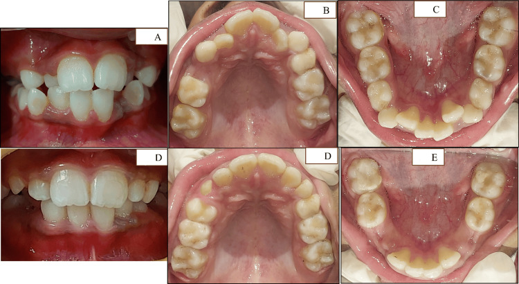 Figure 12