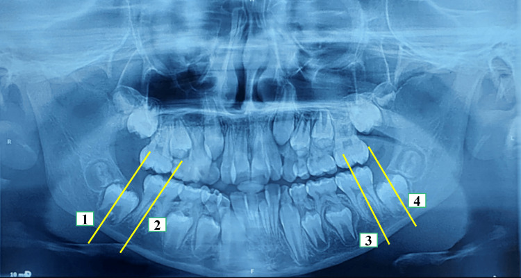 Figure 13