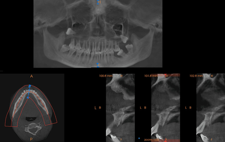 Figure 4