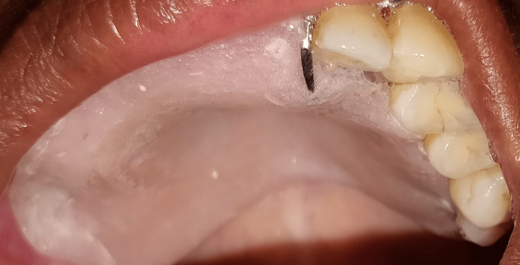 Figure 9
