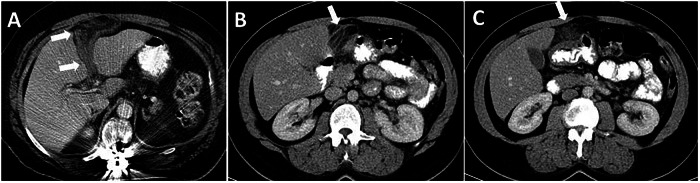 Figure 12