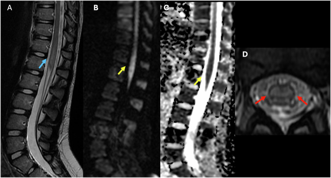 Figure 11
