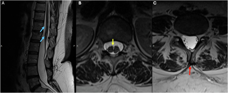 Figure 12