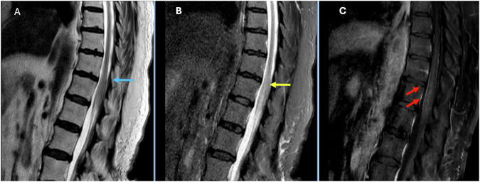 Figure 9