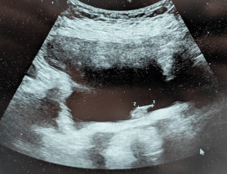 Figure 8
