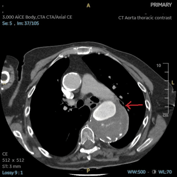 Figure 5