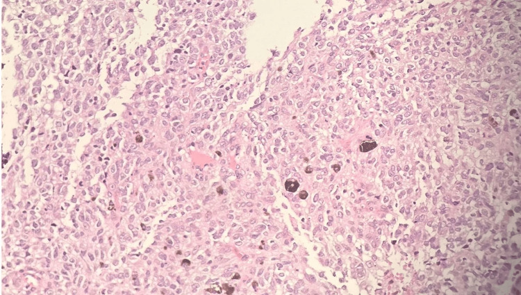 Figure 10
