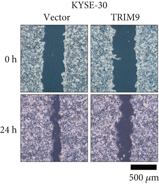 Figure 14