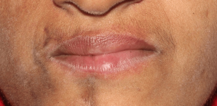 Figure 9