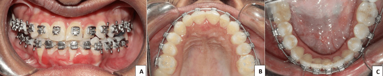 Figure 10