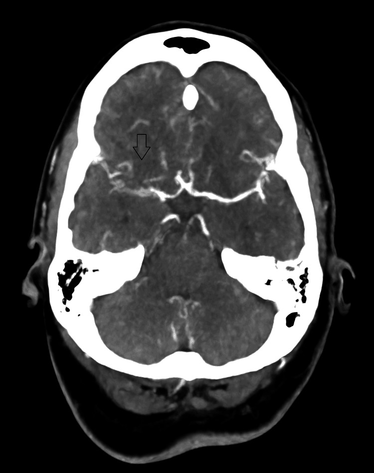 Figure 5