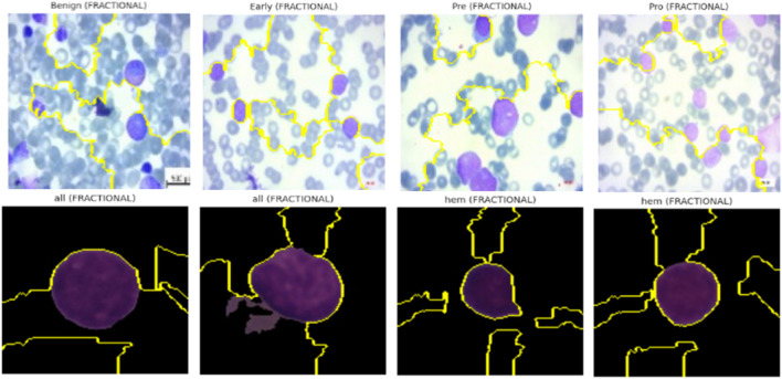 Figure 21