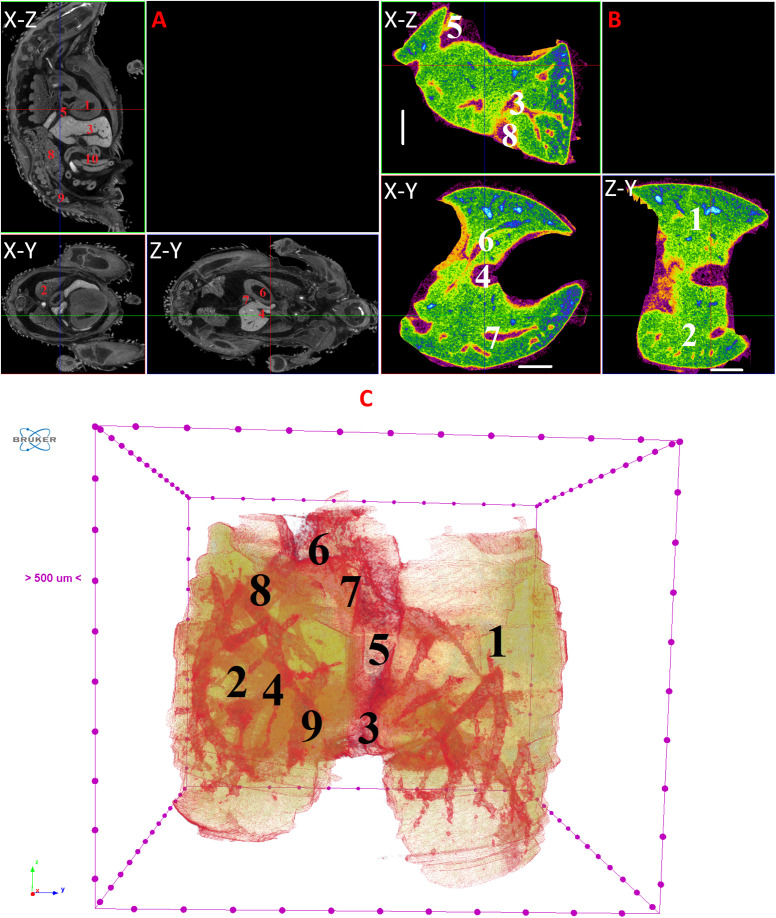 Figure 11