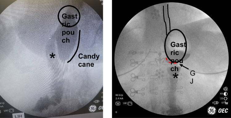 Figure 9