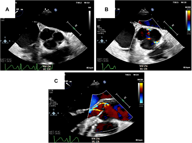 Figure 4