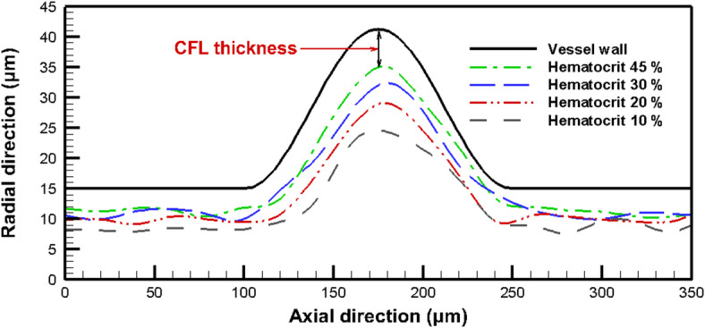 Figure 12