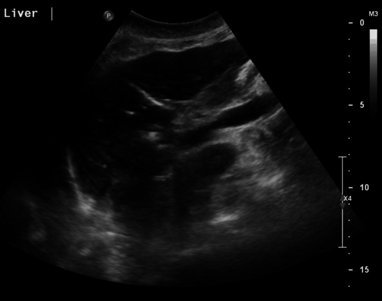 Figure 9