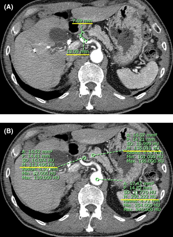 FIGURE 1
