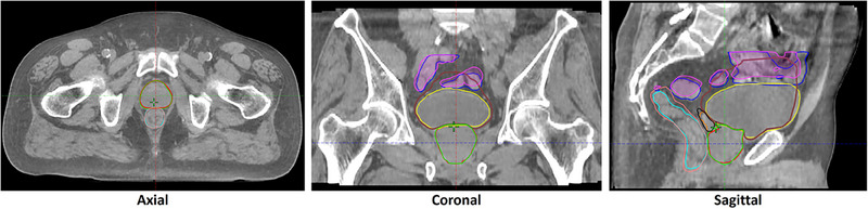 FIGURE 2