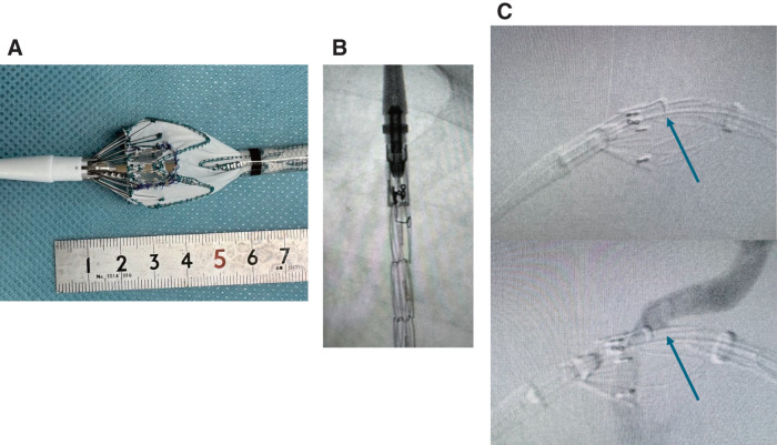 Fig. 2