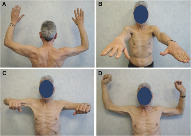 FIGURE 3
