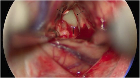 FIGURE 3