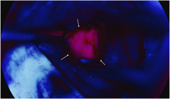 FIGURE 4