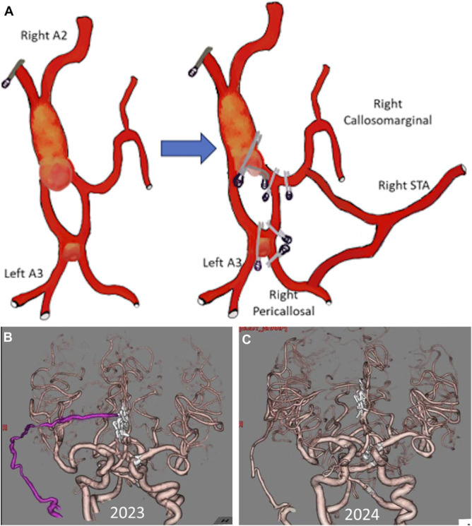 FIGURE 3