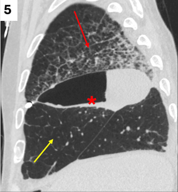 Figure 5
