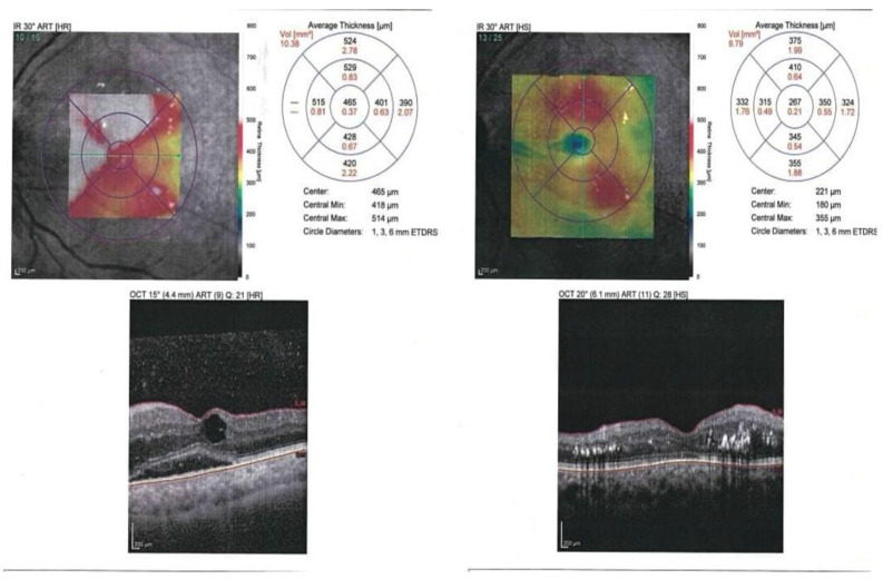 Figure 12