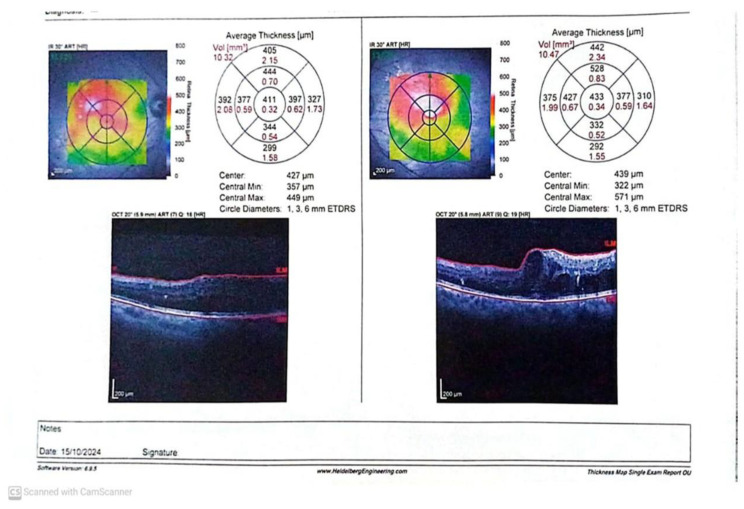 Figure 13