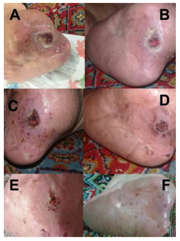 Figure 11
