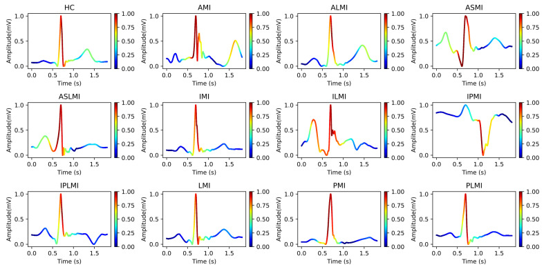Figure 12