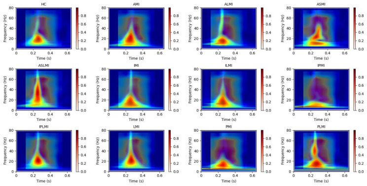 Figure 13