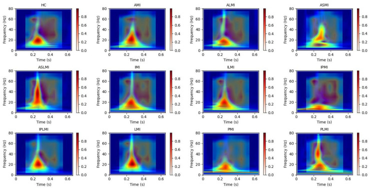 Figure 14