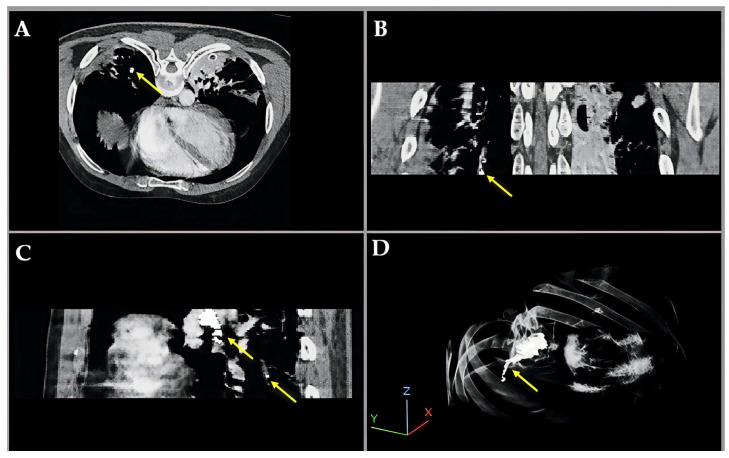 Figure 4